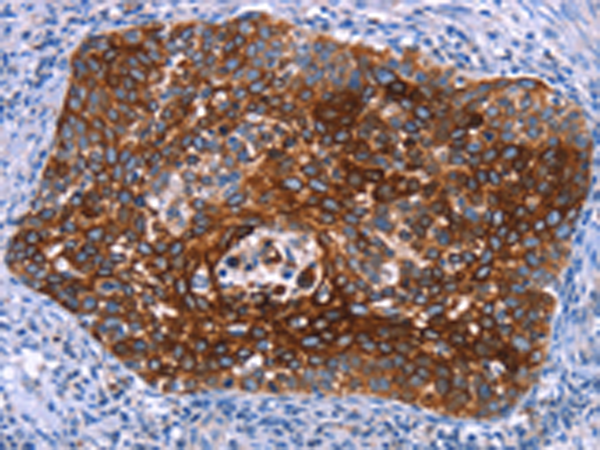 Rabbit Polyclonal Antibody to MAP3K2