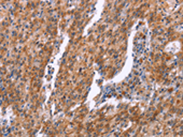 Rabbit Polyclonal Antibody to RPS6KA6