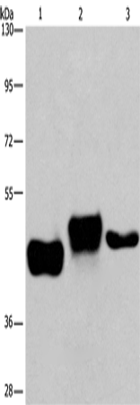 Rabbit Polyclonal Antibody to SGK2