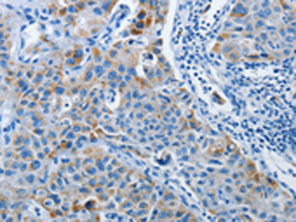 Rabbit Polyclonal Antibody to PRKG2