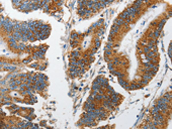 Rabbit Polyclonal Antibody to MARK2