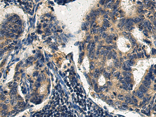 Rabbit Polyclonal Antibody to BOK(BH3 domain)