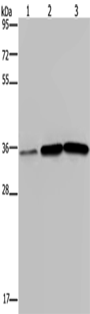 Rabbit Polyclonal Antibody to MAGEA3