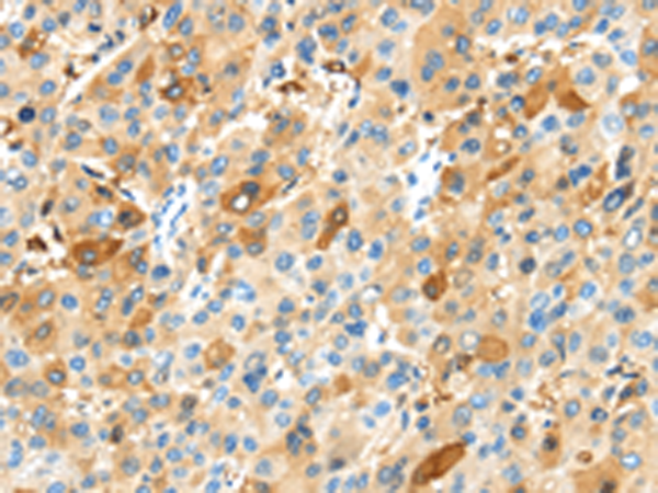 Rabbit Polyclonal Antibody to MAP3K10