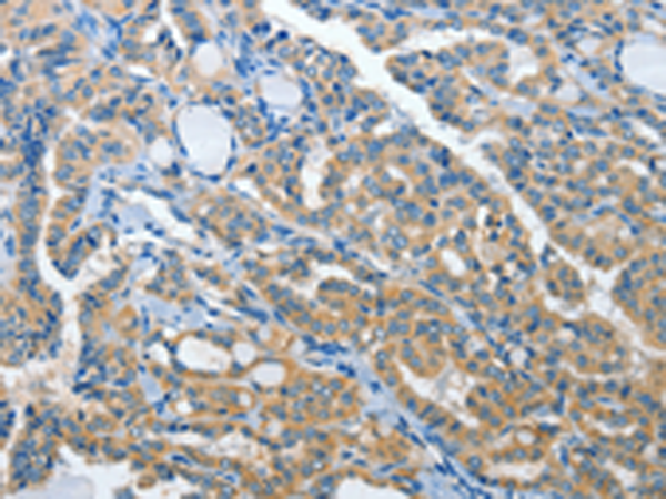 Rabbit Polyclonal Antibody to PRKX