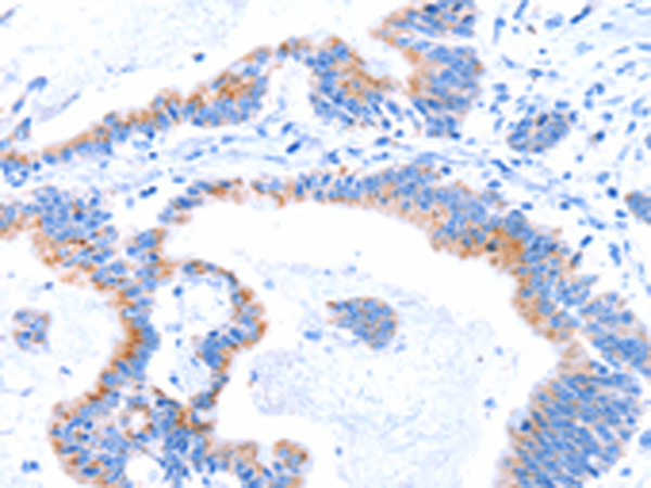 Rabbit Polyclonal Antibody to SMG8