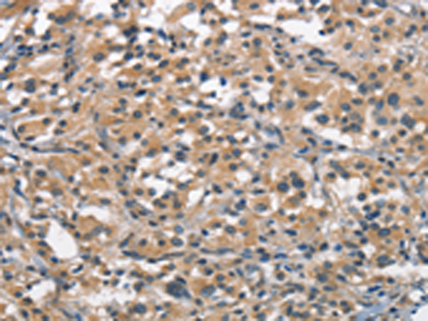 Rabbit Polyclonal Antibody to ACP4