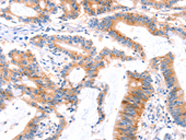 Rabbit Polyclonal Antibody to AFDN