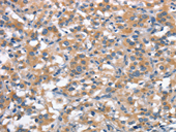 Rabbit Polyclonal Antibody to ANP32C