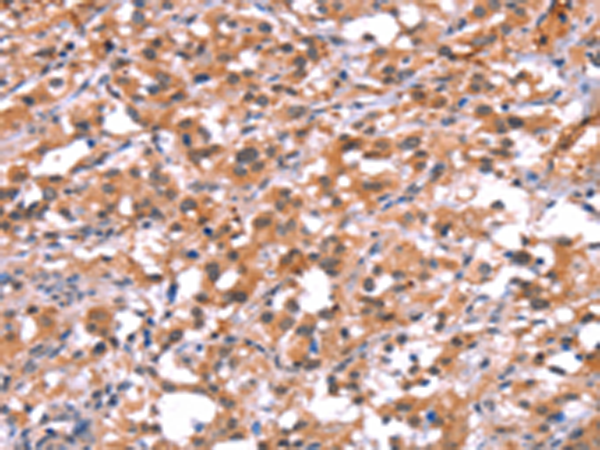 Rabbit Polyclonal Antibody to BCAR1