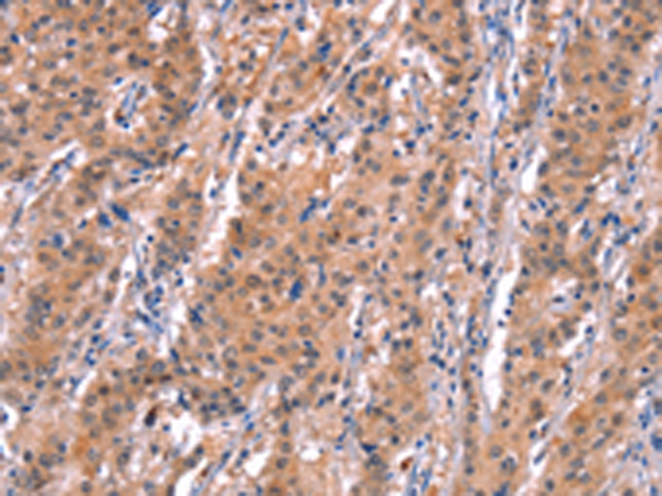 Rabbit Polyclonal Antibody to BCL6