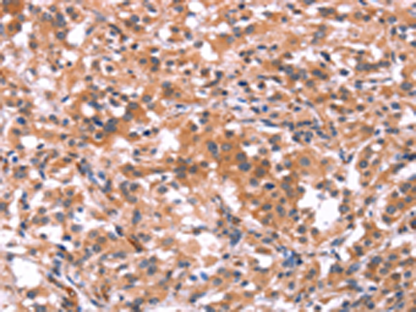 Rabbit Polyclonal Antibody to BCR