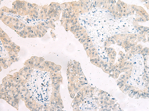 Rabbit Polyclonal Antibody to ARRB1