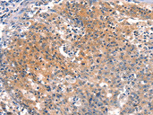 Rabbit Polyclonal Antibody to BFAR