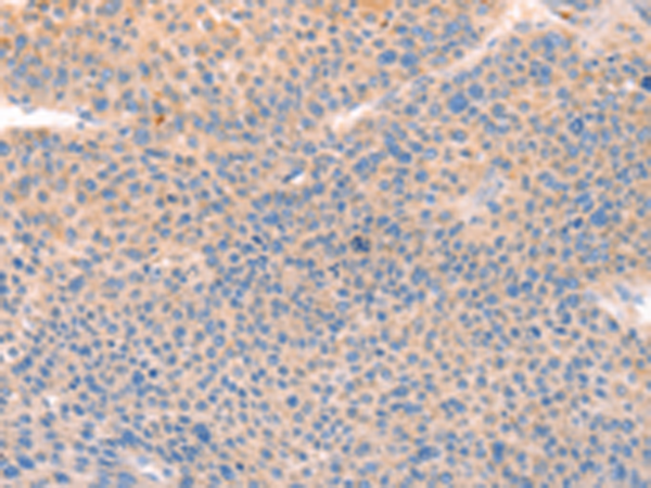 Rabbit Polyclonal Antibody to CD109