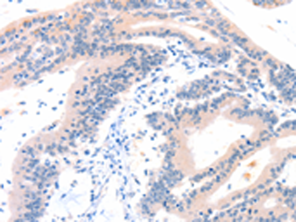 Rabbit Polyclonal Antibody to ITGA6