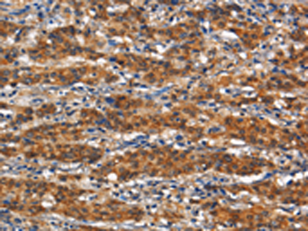 Rabbit Polyclonal Antibody to ANPEP
