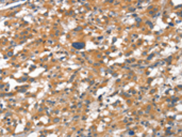 Rabbit Polyclonal Antibody to CDH5