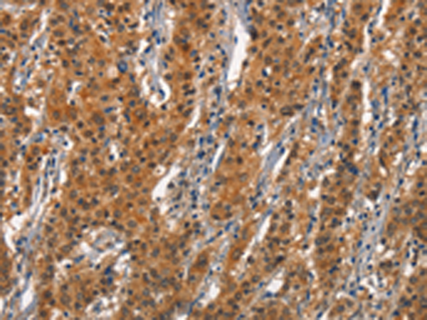 Rabbit Polyclonal Antibody to CD163