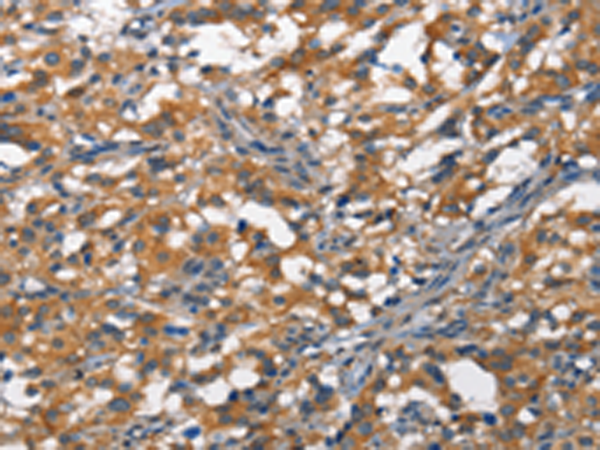 Rabbit Polyclonal Antibody to DDR2