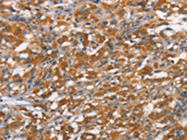 Rabbit Polyclonal Antibody to HMMR