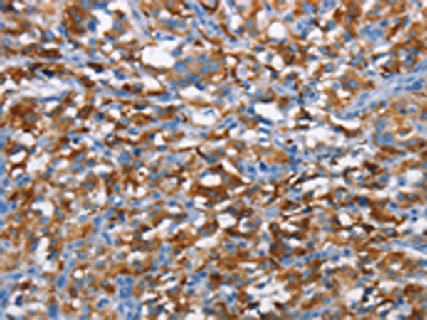 Rabbit Polyclonal Antibody to CD226
