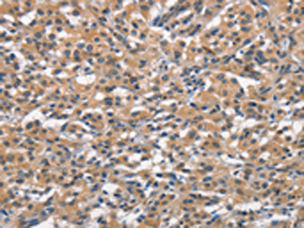 Rabbit Polyclonal Antibody to OLR1