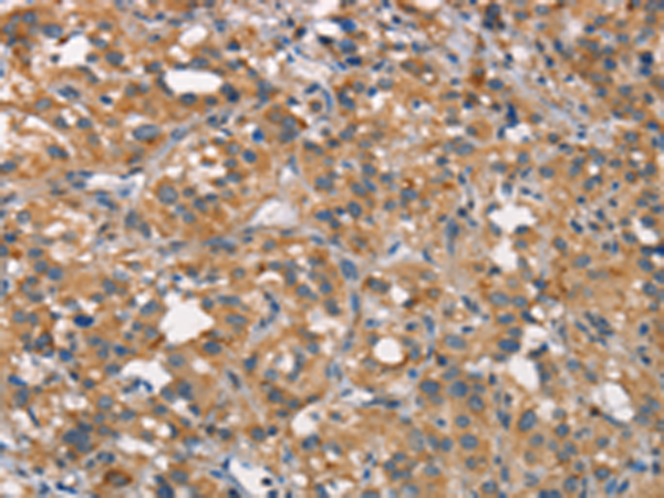 Rabbit Polyclonal Antibody to CEACAM6