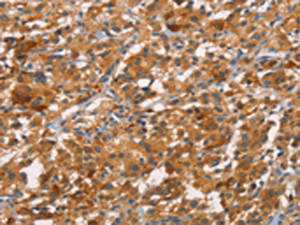 Rabbit Polyclonal Antibody to CDC25B