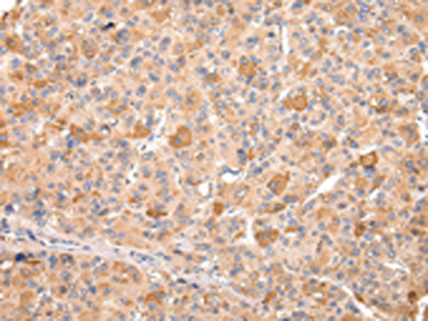 Rabbit Polyclonal Antibody to RERE