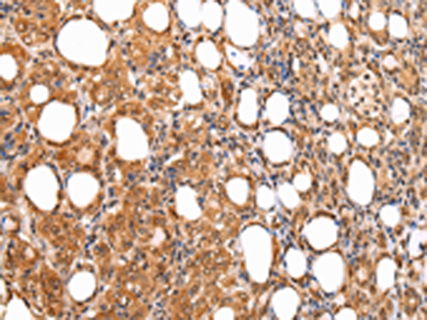 Rabbit Polyclonal Antibody to KEAP1