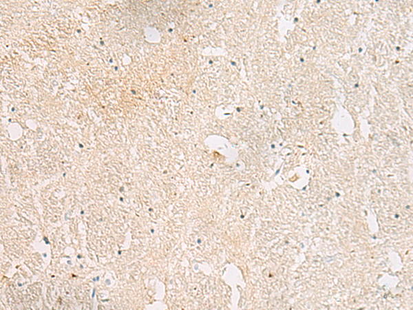 Rabbit Polyclonal Antibody to AKAP3