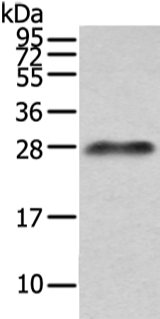 Rabbit Polyclonal Antibody to Lambda Light chain