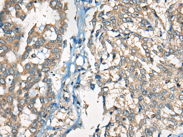 Rabbit Polyclonal Antibody to Kappa Light chain