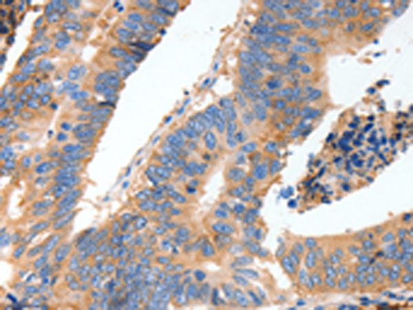 Rabbit Polyclonal Antibody to MUC6