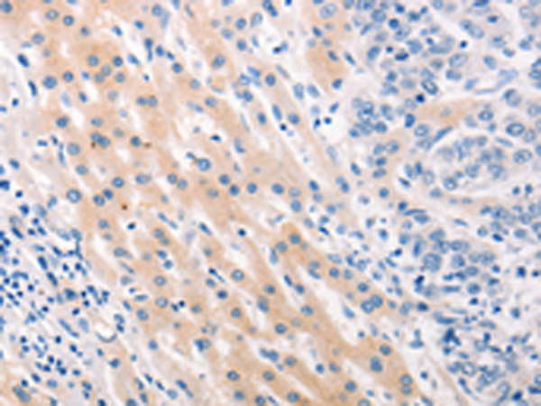 Rabbit Polyclonal Antibody to MUC2
