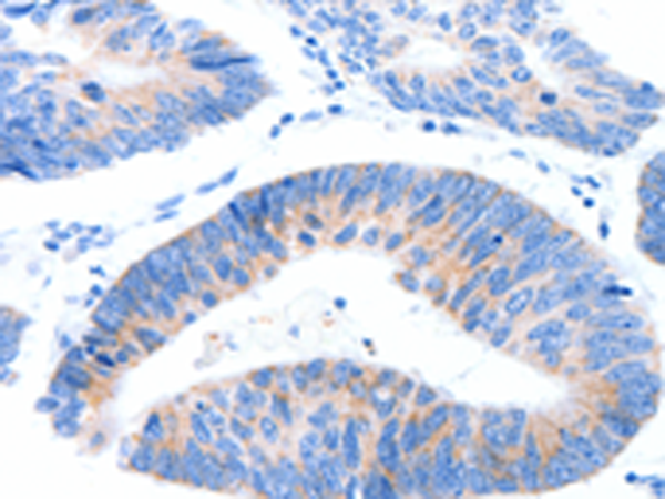 Rabbit Polyclonal Antibody to MUC3A