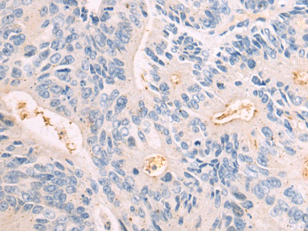 Rabbit Polyclonal Antibody to MUC5B