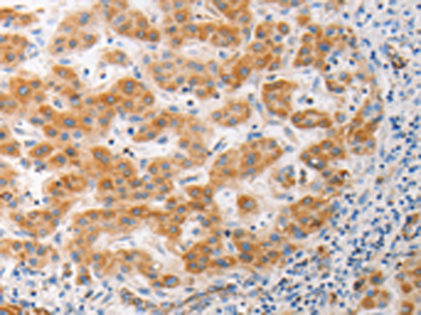 Rabbit Polyclonal Antibody to MUC13