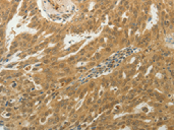 Rabbit Polyclonal Antibody to MYSM1