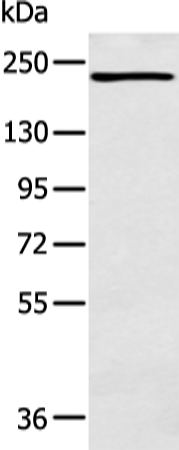 Rabbit Polyclonal Antibody to NCOR2