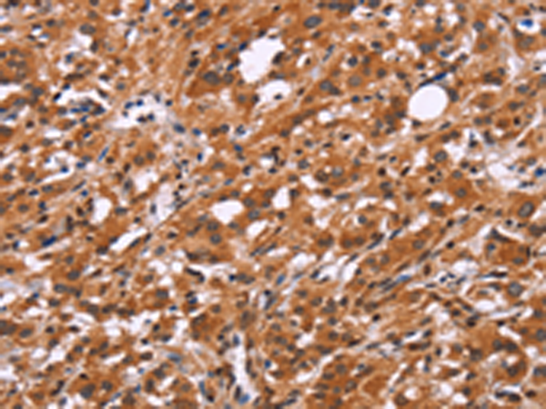 Rabbit Polyclonal Antibody to SLC8A2