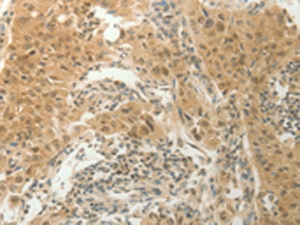 Rabbit Polyclonal Antibody to SLC8A3