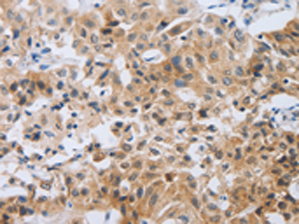 Rabbit Polyclonal Antibody to NEB