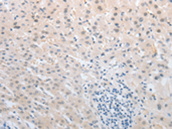 Rabbit Polyclonal Antibody to NFAT5