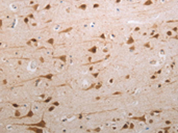 Rabbit Polyclonal Antibody to MDC1