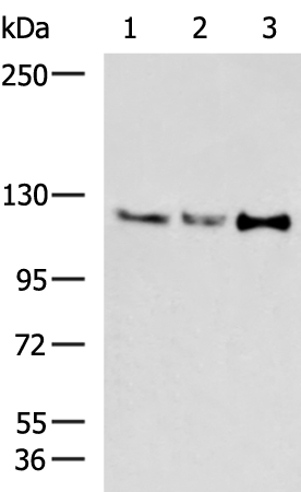 Rabbit Polyclonal Antibody to NFKB2