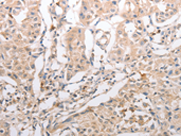 Rabbit Polyclonal Antibody to INA