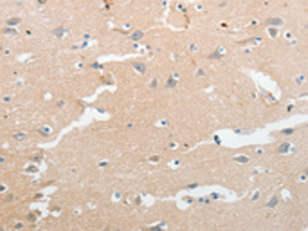 Rabbit Polyclonal Antibody to LCN2