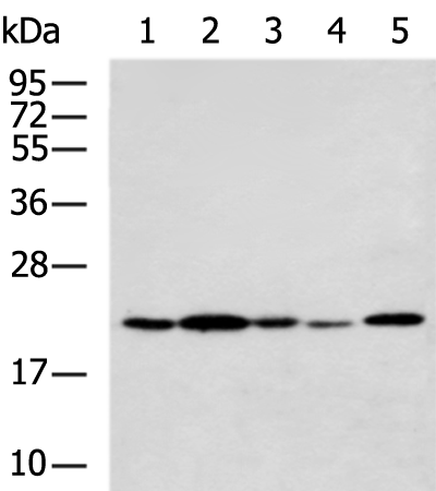Rabbit Polyclonal Antibody to NEUROG1